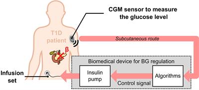 Towards the Integration of an Islet-Based Biosensor in Closed-Loop Therapies for Patients With Type 1 Diabetes